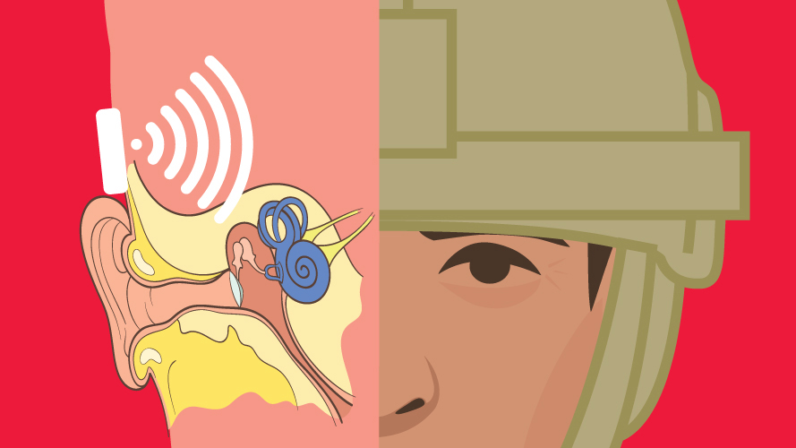 Bone Conduction Technology - Image